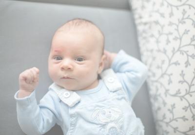 First Aid For Babies: Bruises, Scars, Cuts, Wounds, And Scrapes