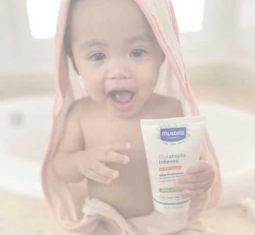 cradle cap vs. eczema - Mustela USA - 1