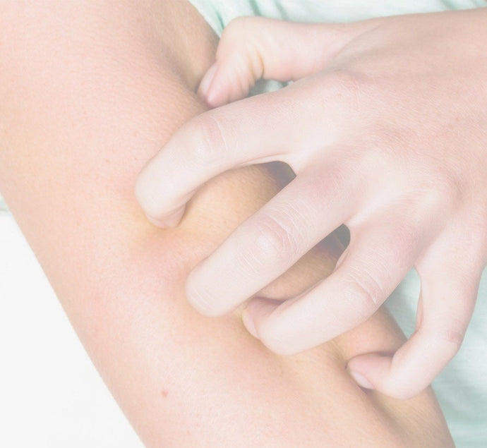 Psoriasis Vs. Eczema: How To Know Which One You're Dealing With