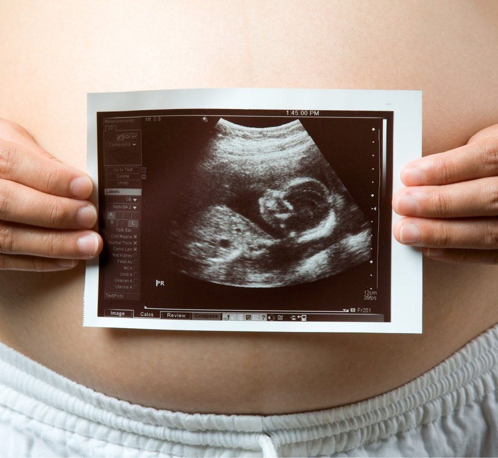 5 months pregnant baby kicking alot cheap