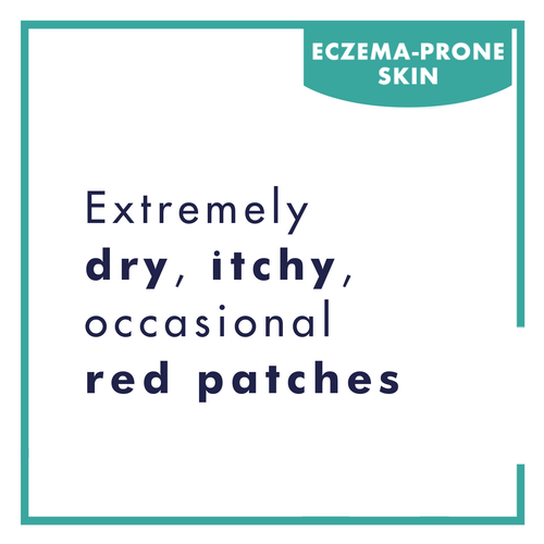 download_7 - Mustela USA - 1